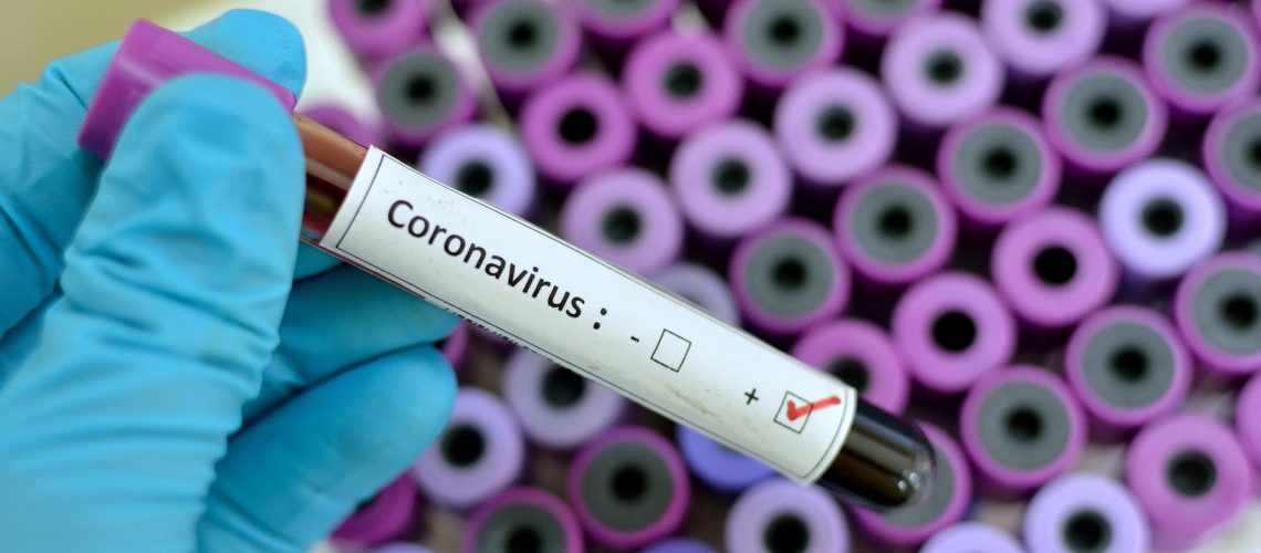 coronavirus business air travel positive test